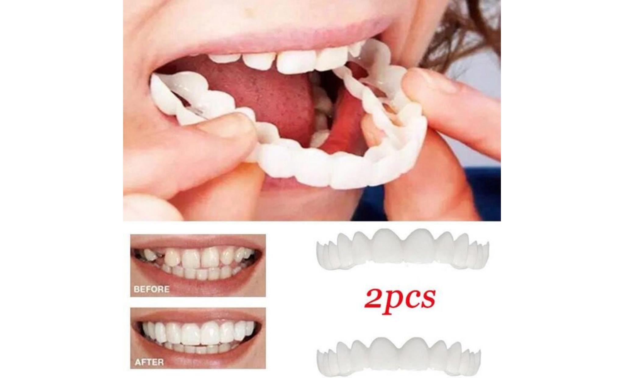 2pcs kit de prothèse dentaire dentifrice couvre dents faciales