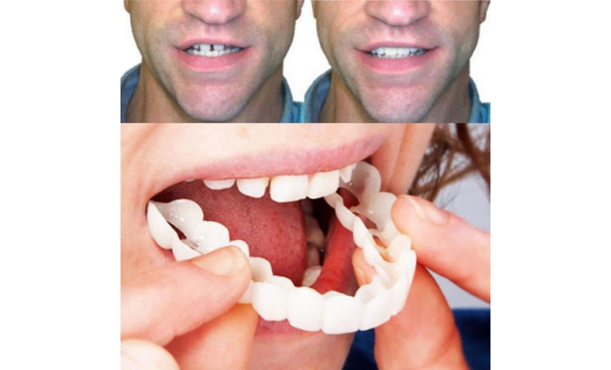 accessoire pour prothèses dentaires avec fausse dent et dents blanches comfort fit flex pour hommes, femmes pas cher